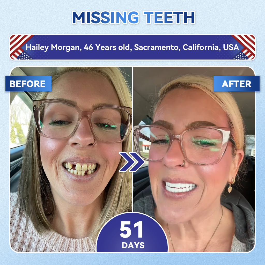 Alisanda® 🦷 Tideglusib Fast‑Dissolving Tooth & Gum Repair Oral Strips ✨